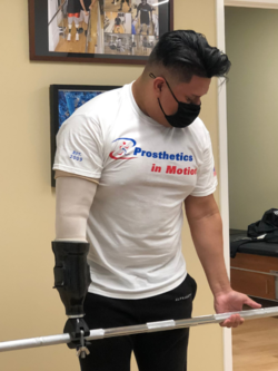 Weight lifting prosthetic arm